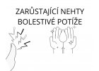 Zarůstání nehtů, bolestivé potíže