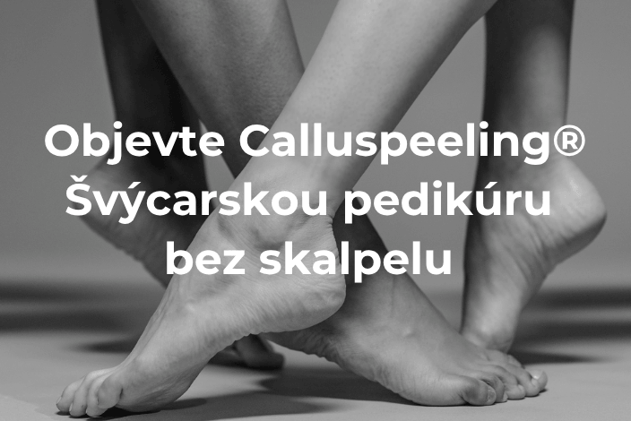Calluspeeling