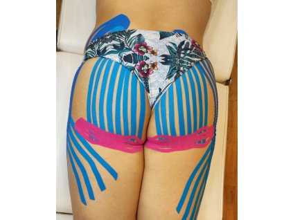 Face-to-face course of Dr. Nek anti-cellulite taping of thighs and buttocks