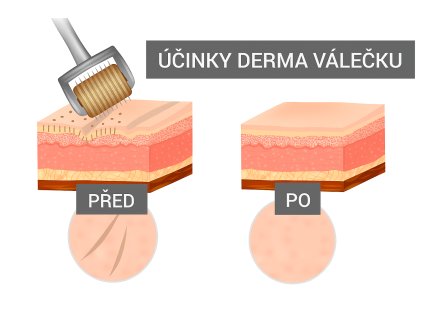 Dr.nek Cosmetics Kyselina hyaluronová sérum 30ml v sete s dermaroller 0,25mm
