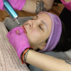 Curso presencial Dr. Nek de hyaluron pen automática 2