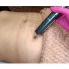Dr.Nek Curso online de hyaluron pen automática con equipo, materiales didácticos impresos y certificado