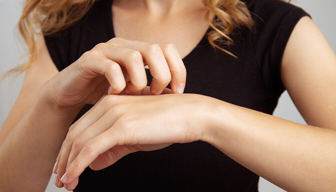 Psoriáza: Tajomstvo, Ktoré Vás Ohromí