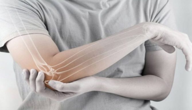 Diagnostika a možnosti liečby entezopatie
