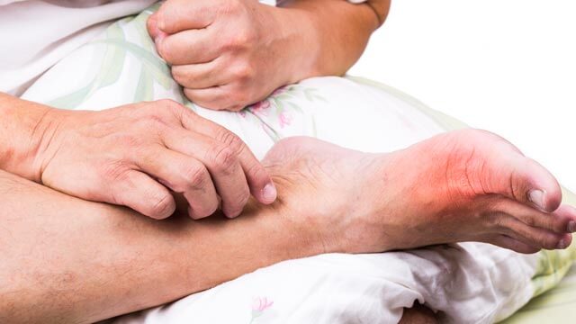 Ako znížiť riziko dny: 6 praktických krokov