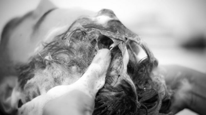 Ako si vybrať šampón na seboroickú dermatitídu a iné tipy