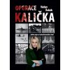 1 operace kalicka
