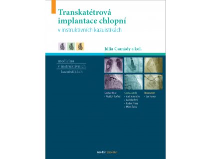 TAVI v instruktivnich kazuistikach Maxdorf 150