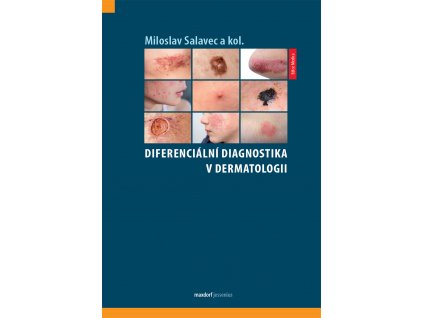 Diferencialni diagnostika v dermatologii Maxdorf 150