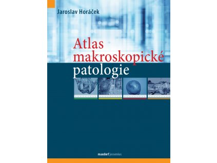 Atlas makroskopicke patologie Maxdorf 150