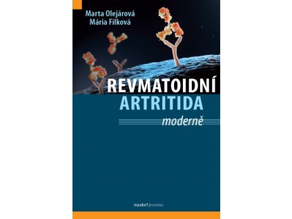 Revmatoidni artritida moderne Maxdorf 150