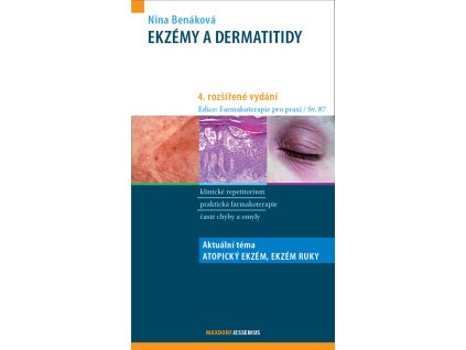 Ekzemy a dermatitidy 4 vyd Maxdorf 150