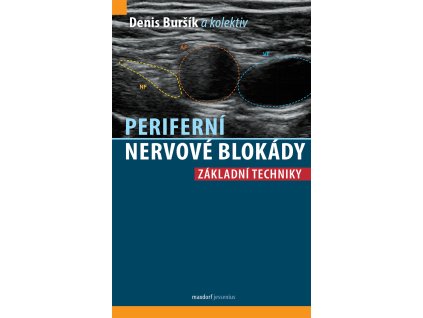 Periferni nervove blokady Maxdorf 150