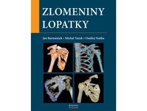 Zlomeniny lopatky Maxdorf 150