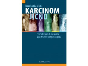 Karcinom jicnu Maxdorf 150