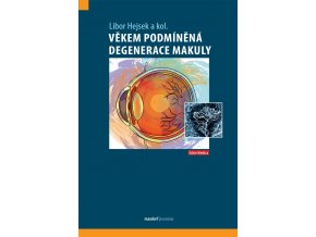 Věkem podmíněná degenerace makuly Maxdorf 150