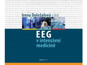 EEG v intenzivni medicine Maxdorf 150
