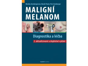 Maligni melanom 2 vyd Maxdorf 150