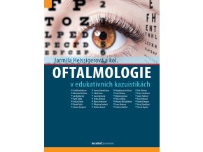 Oftalmologie v edukativních kazuistikach Maxdorf 150
