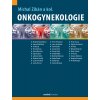 Onkogynekologie Maxdorf 150