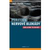 Periferni nervove blokady Maxdorf 150