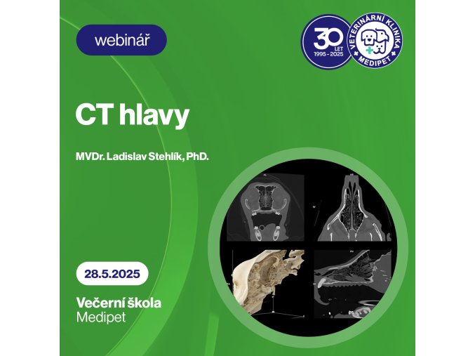 ct hlava