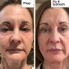 1. před a po contour maska