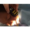 Buzzy® Mini Personal BEE STRIPED - STROJEK PRO ZMÍRNĚNÍ BOLESTI PŘI INJEKCÍCH