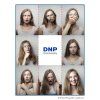 15x20 > 3x (5x20) cm | 400 ks | DNP DS620 Perforated