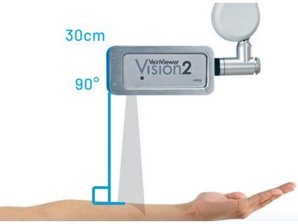 VeinViewer® 4,0 Vision 2