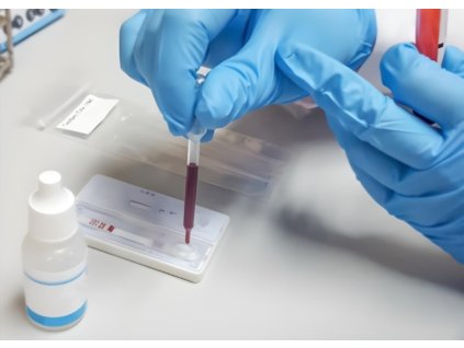 Helicobacter antigen quick