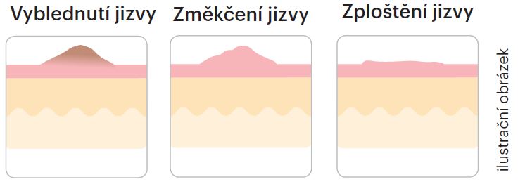 Gel na jizvy Nourisil™ MD