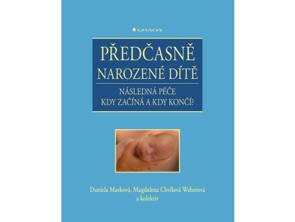 118280 predcasne narozene dite nasledna pece kdy zacina a kdy konci