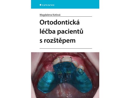 149081 ortodonticka lecba pacientu s rozstepem