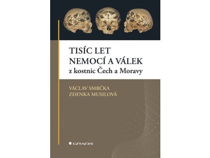 Tisíc let nemocí a válek z kostnic Čech a Moravy