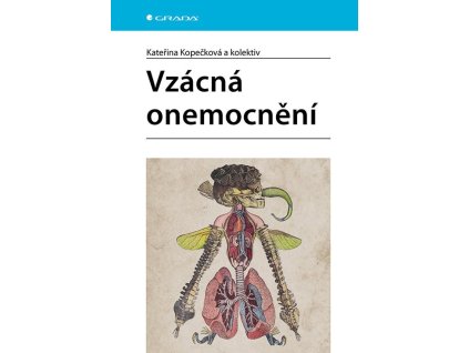 Vzácná onemocnění