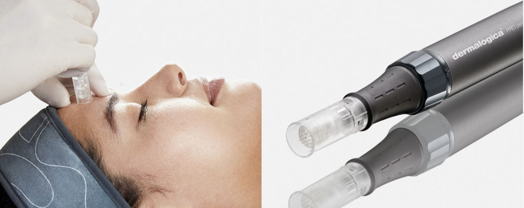 školení Mikrojehličkování + Exo Booster