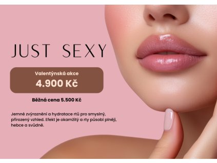 yellow carousel de cs