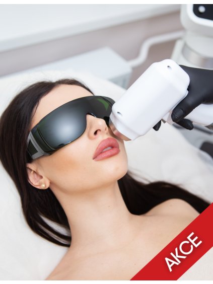 Verjüngung von Gesicht und Hals mit der 808-Diode