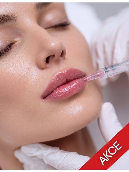 zvětšení rtů (1)