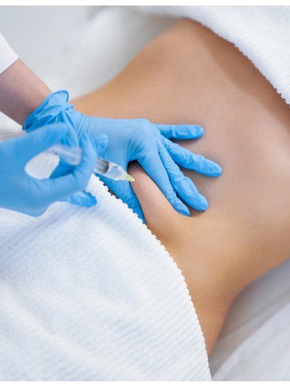 Injection Lipolysis