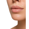 lip lift