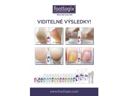 Footlogix Plakát - Viditelné výsledky - Před a Po