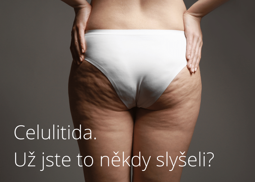 Celulitida. Už jste to někdy slyšeli?