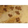 mycelia pro pestovani lanyzu tuber