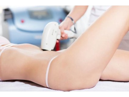 Bezbolestná radiofrekvenční liposukce