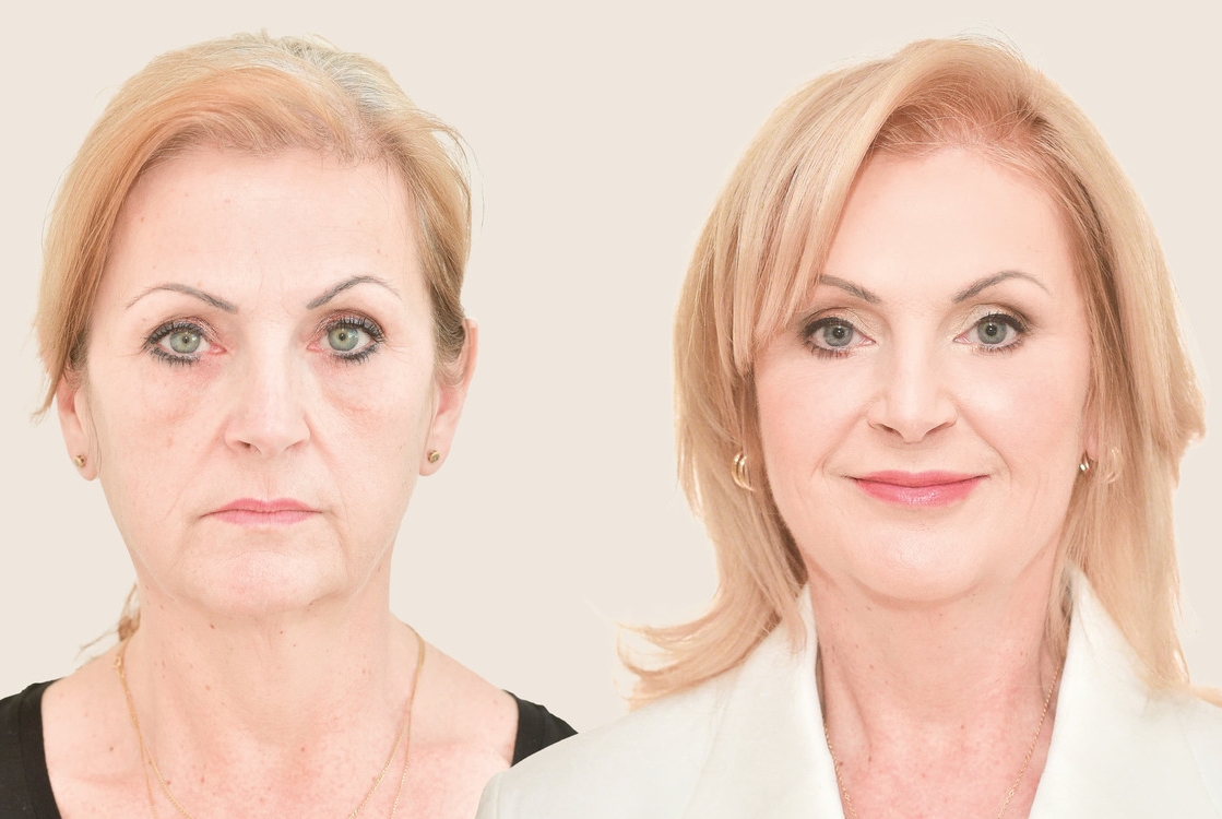 Vysněná krása: Učitelka Šárka ví, že ji budou hodnotit i žáci, přesto do proměny jde. Taky „úča“ má totiž právo být krásná. Sledujte cestu za splněným snem už 2. května na Primě