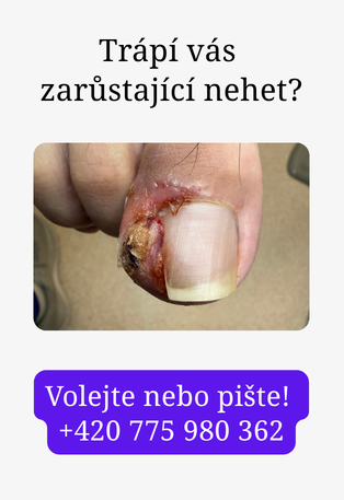 Zarustajici nehet