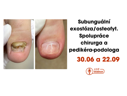 YouTube banner webinar