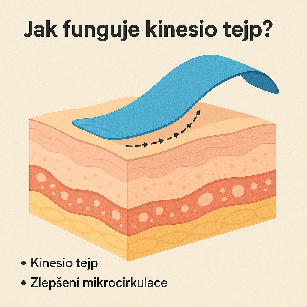 Jak funguje kinesio tejp?